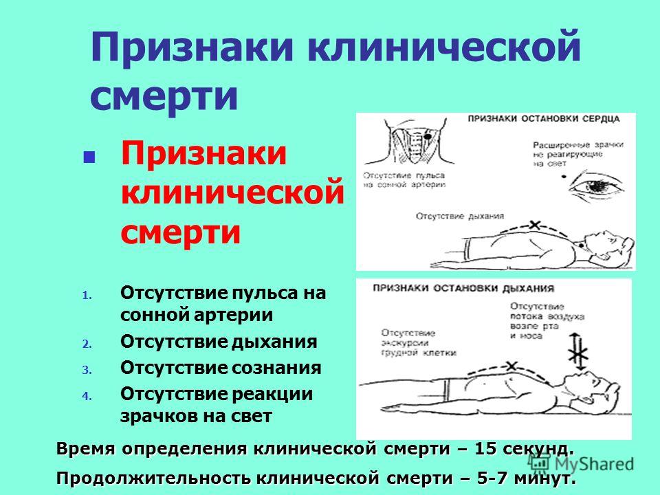 Признаки клинической смерти картинки